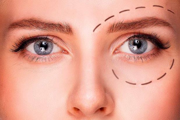 بهترین کرم برای رفع افتادگی پلک کدام است؟